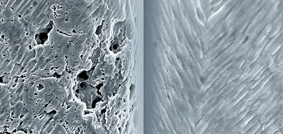 Microscopic before-and-after comparison of enamel surface treated with Dr. Jen's Fluoride-Free toothpaste